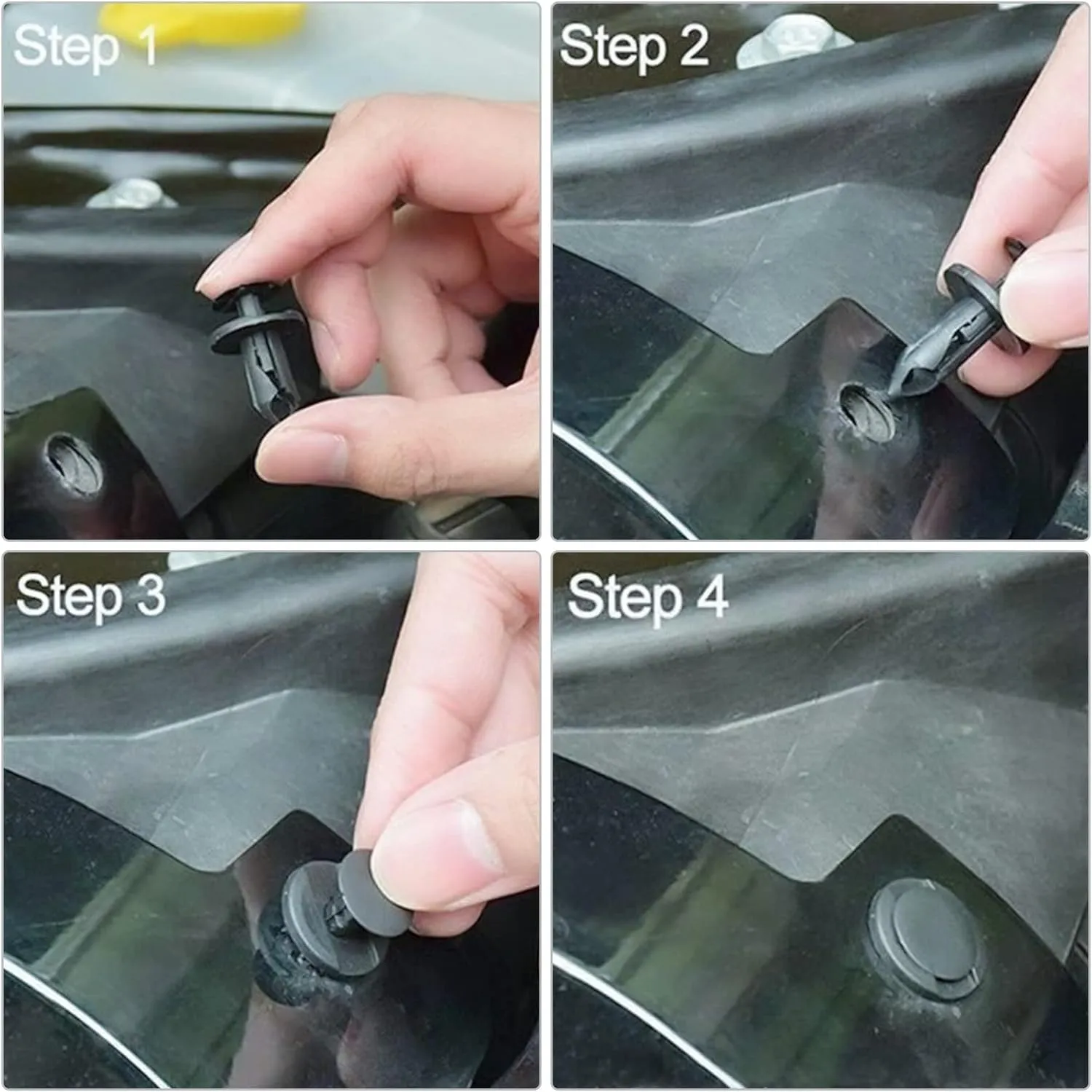 415Pcs Of Retainer Clippers Kit