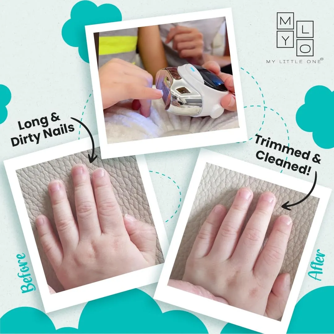 MyLO Astronaut Electric Nail Clipper Trimmer for Baby & Kids Astronaut (1yr Warranty ) - FOC 2 Paraben-Free Fever Cooling Patch Box