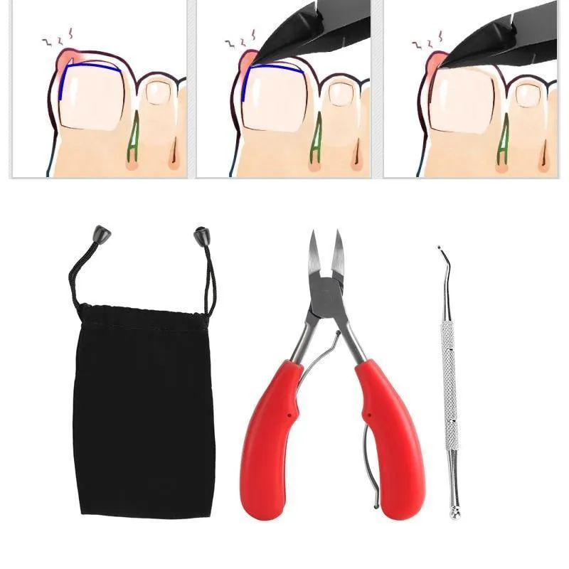 Toenail Clippers