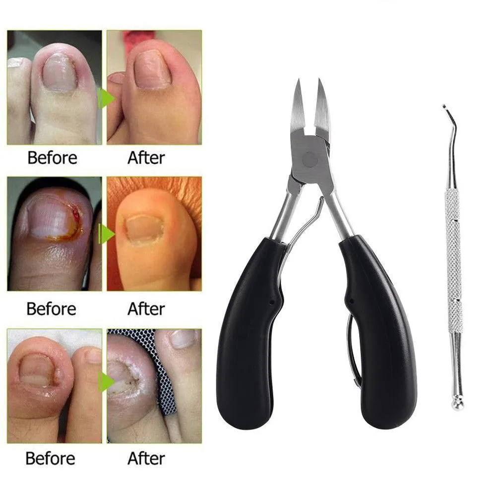 Toenail Clippers